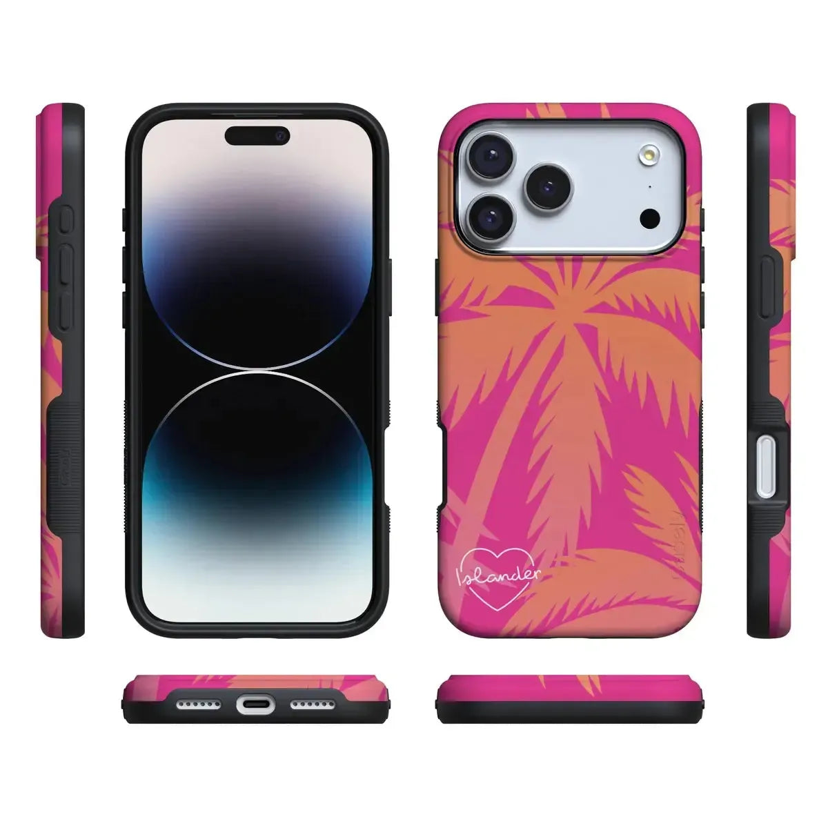Islander | Love Island Case